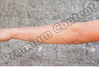 Forearm texture of street references 404 0001